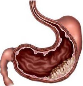 胃炎吃角瓜行吗,缓解不适新选择