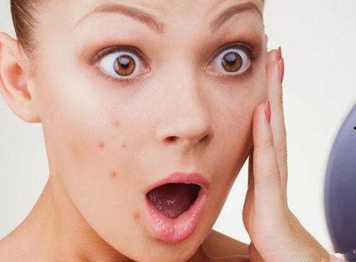 痤疮可以吃蜜瓜不,美味与健康的完美结合