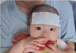 儿童感冒吃瓜好吗